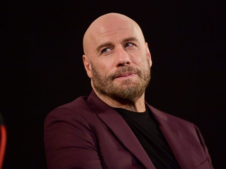 Frisuren für Geheimratsecken - Glatze