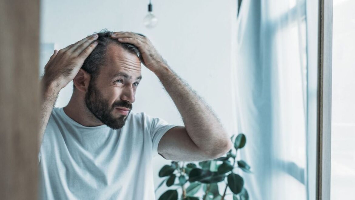 Mittel gegen Haarausfall: So bekommst Du wieder volles Haar