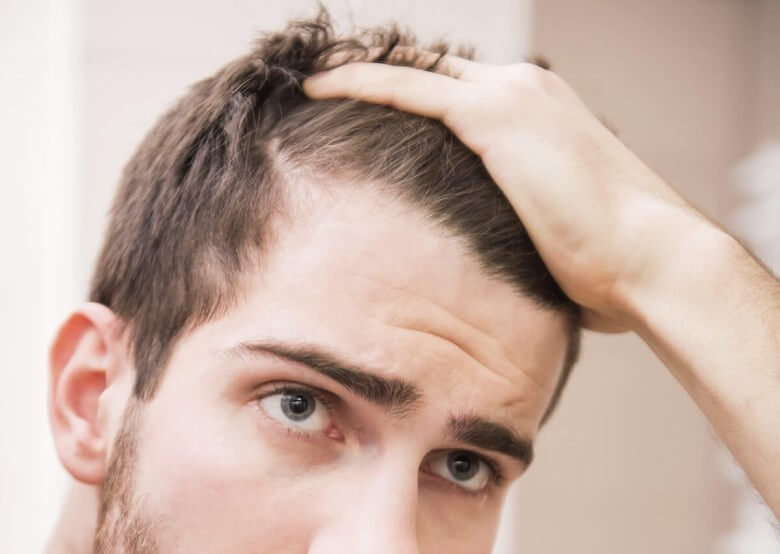 Mittel gegen Haarausfall: Volles Haar bei Männern