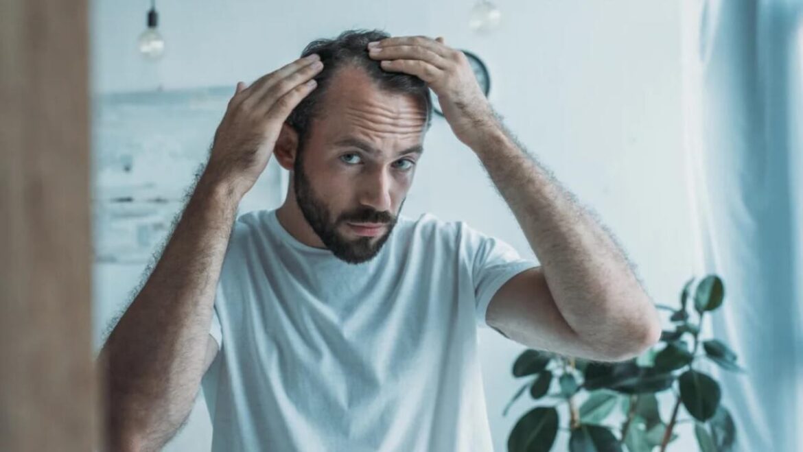 Saisonaler Haarausfall - Hilfe für Männer