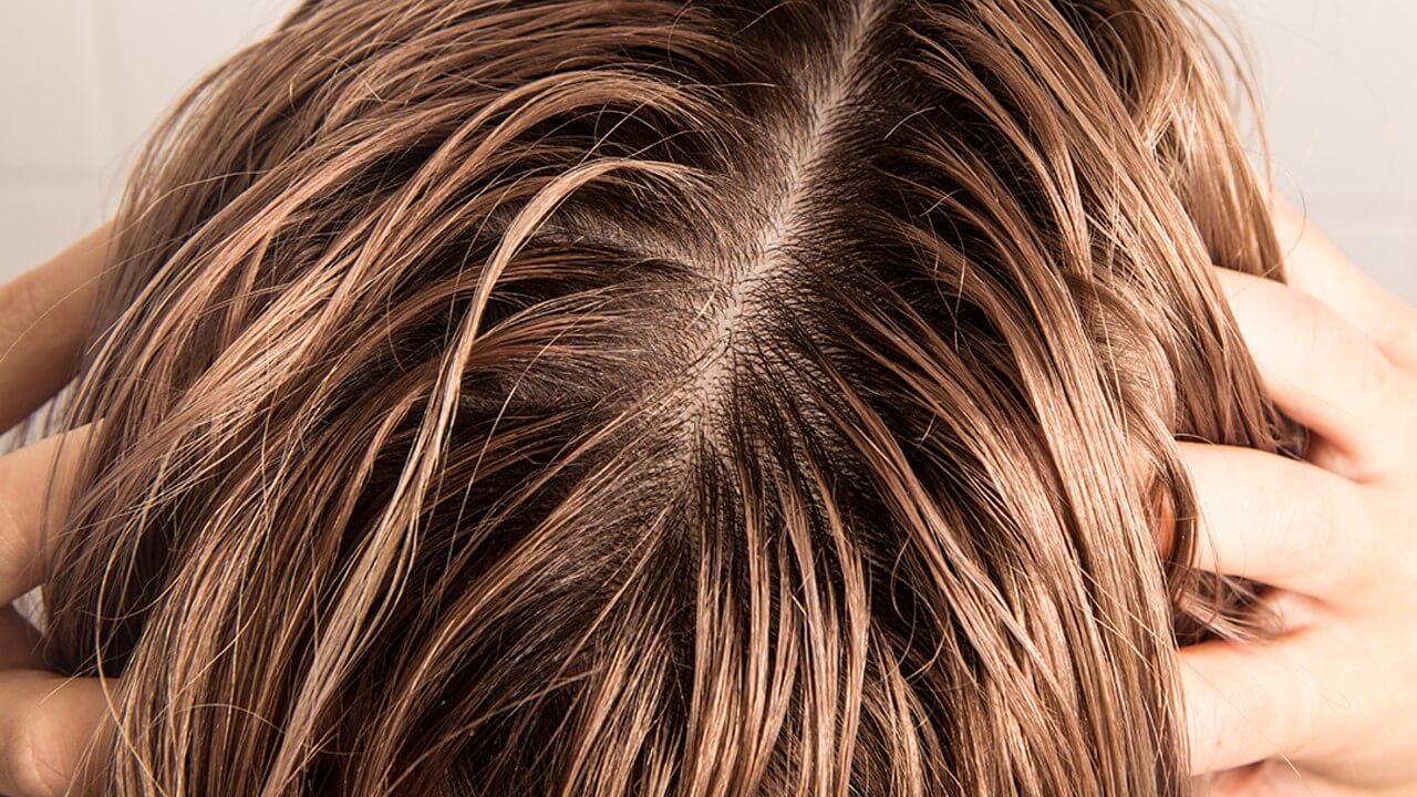 Fettige Haare - Ratgeber für Männer