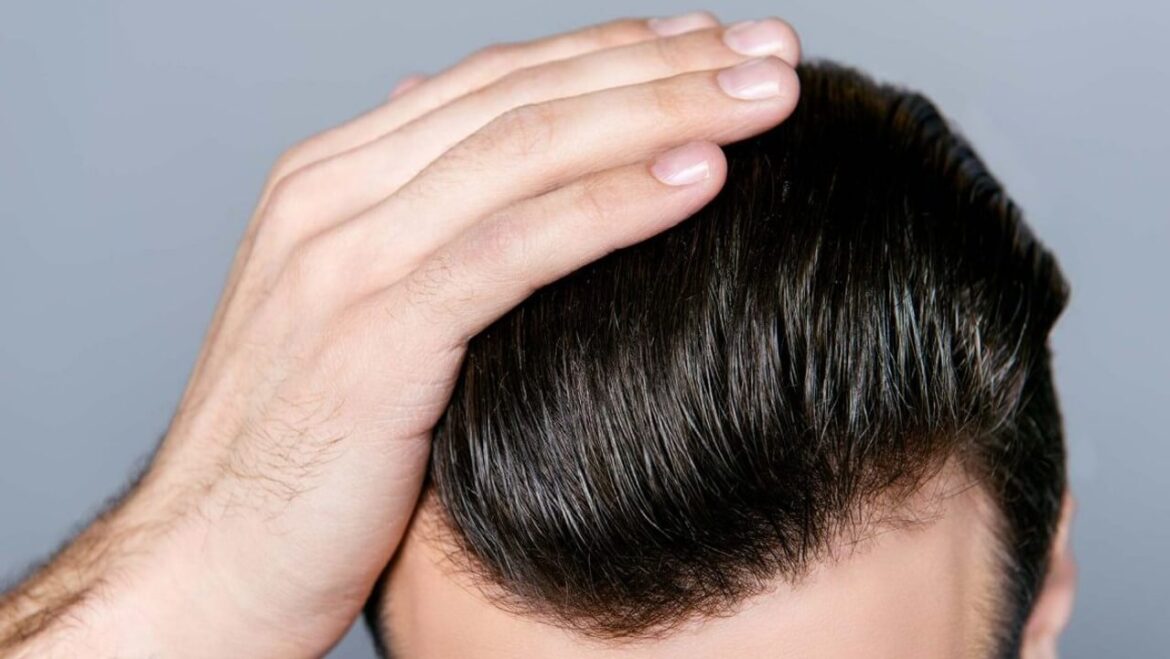 Fragen zur Haartransplantation bei Männer