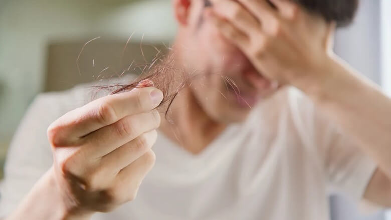 Ursachen für Haarausfall bei Männer