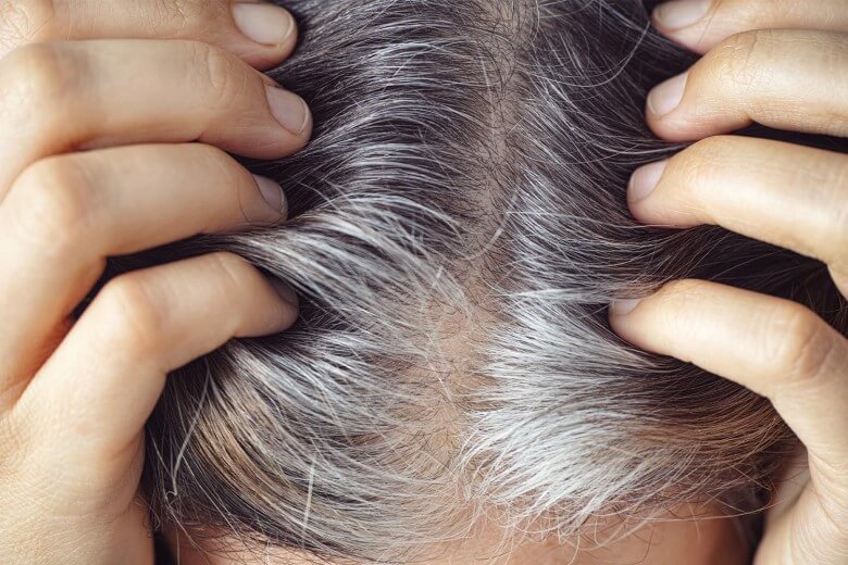 Gelbstich bei grauen Haaren