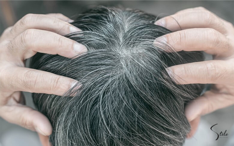 Kopfhautpflege bei grauen Haaren