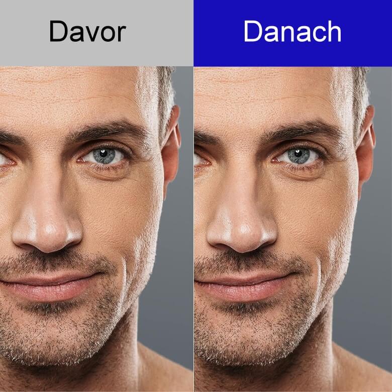 Retinol Männer Anwendung