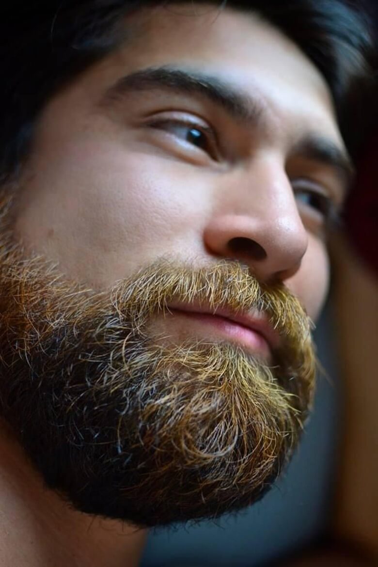 Graue Barthaare - Gelbstich