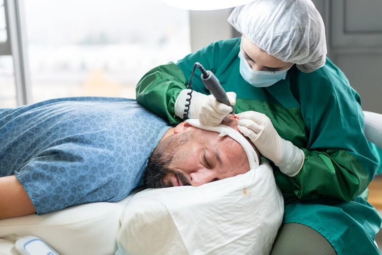 Wie lange dauert die Heilung nach einer Haartransplantation?