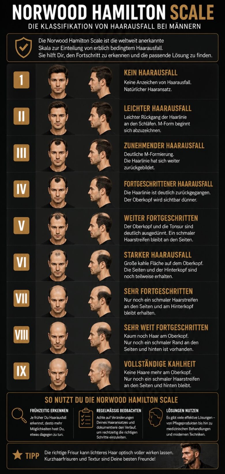 Haarausfall: Norwood-Hamiltin-Scale
